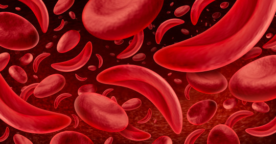 Sickle cell shaped blood cells.